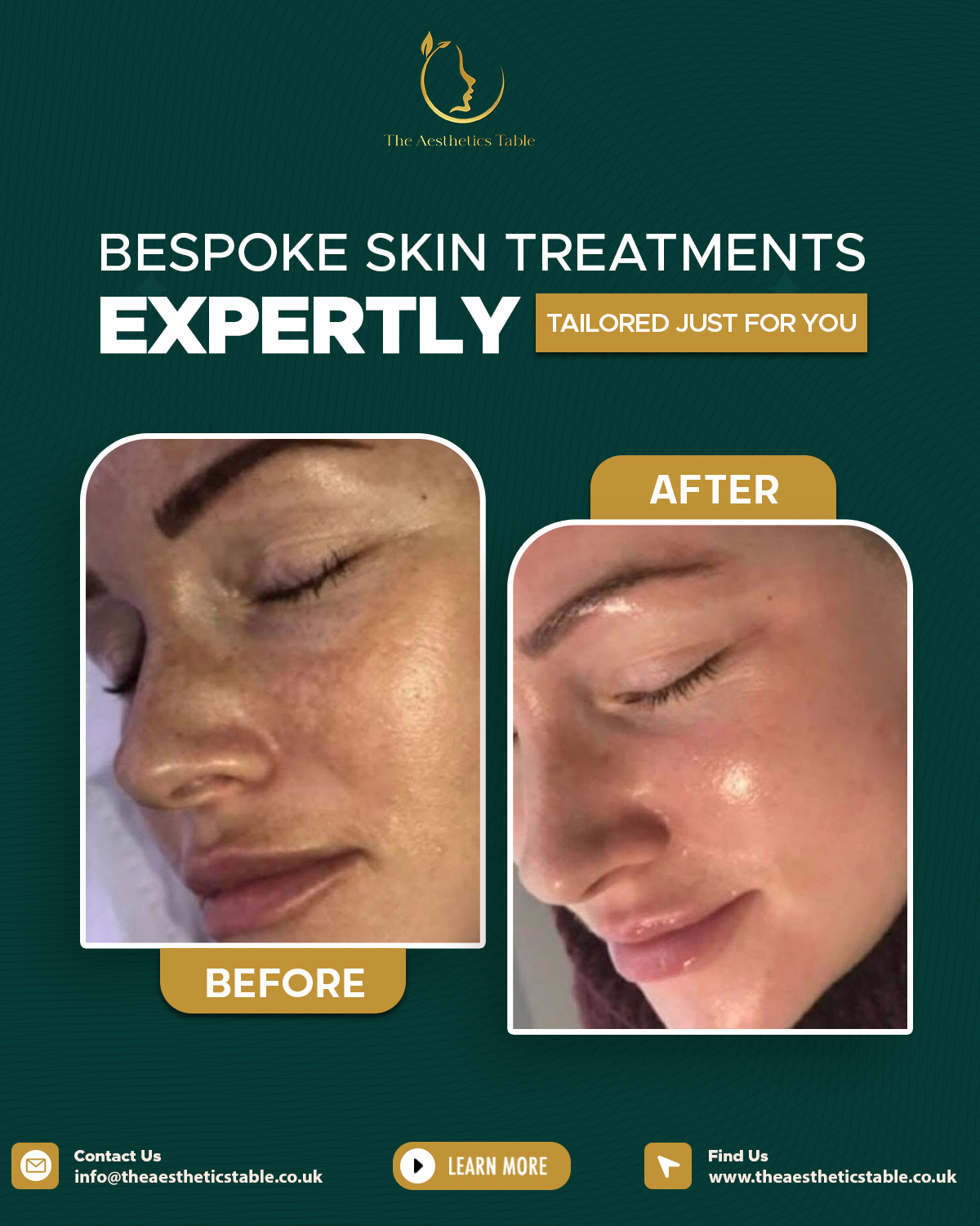 Bespoke Skin - SM Post - The Aesthetics Table