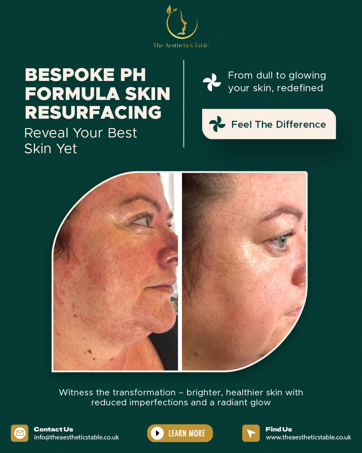 Feel The Difrence - SM Post - The Aesthetics Table (01)