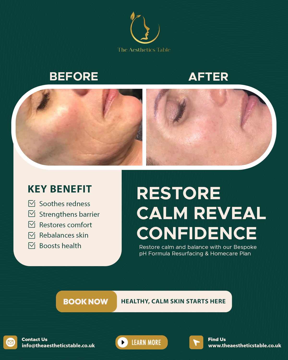 Resotre Calm Reveal - SM Post - The Aesthetics Table