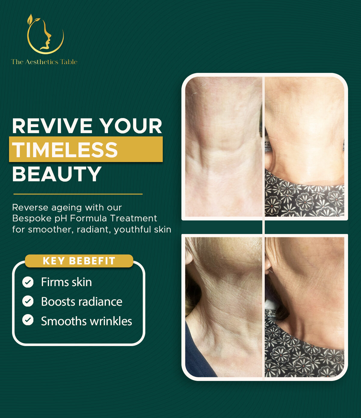 Before and after skin rejuvenation results showing smoother, youthful neck skin