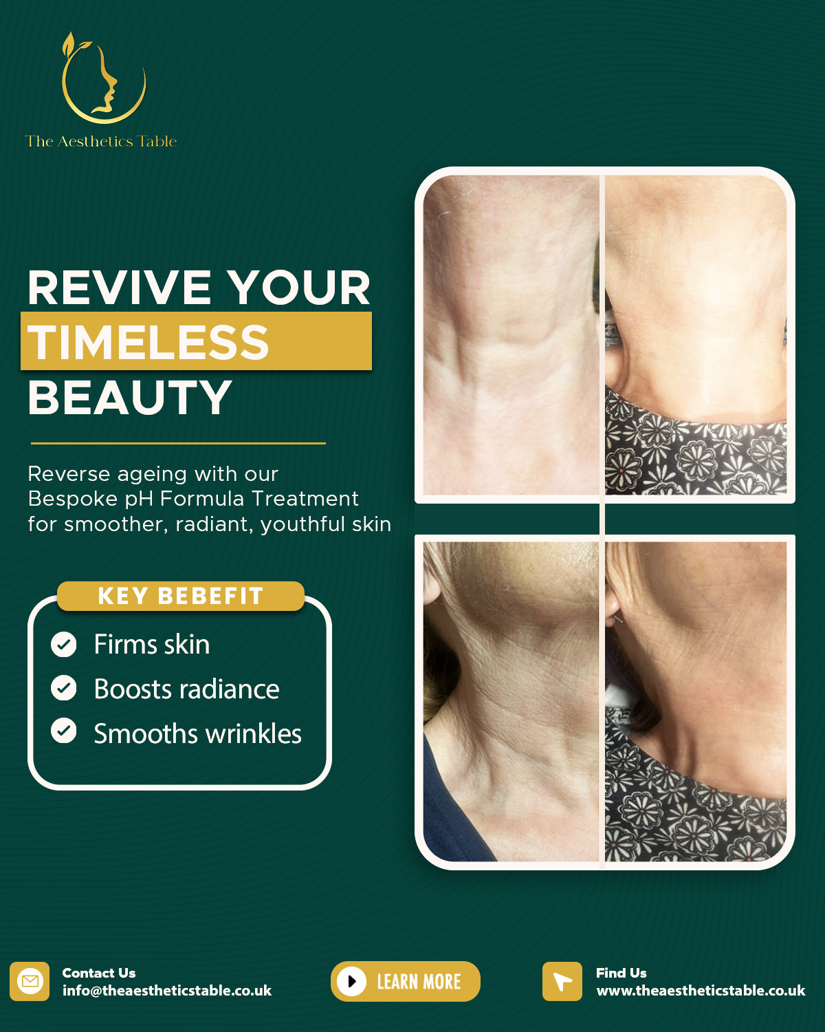 Revive Your - SM Post - The Aesthetics Table