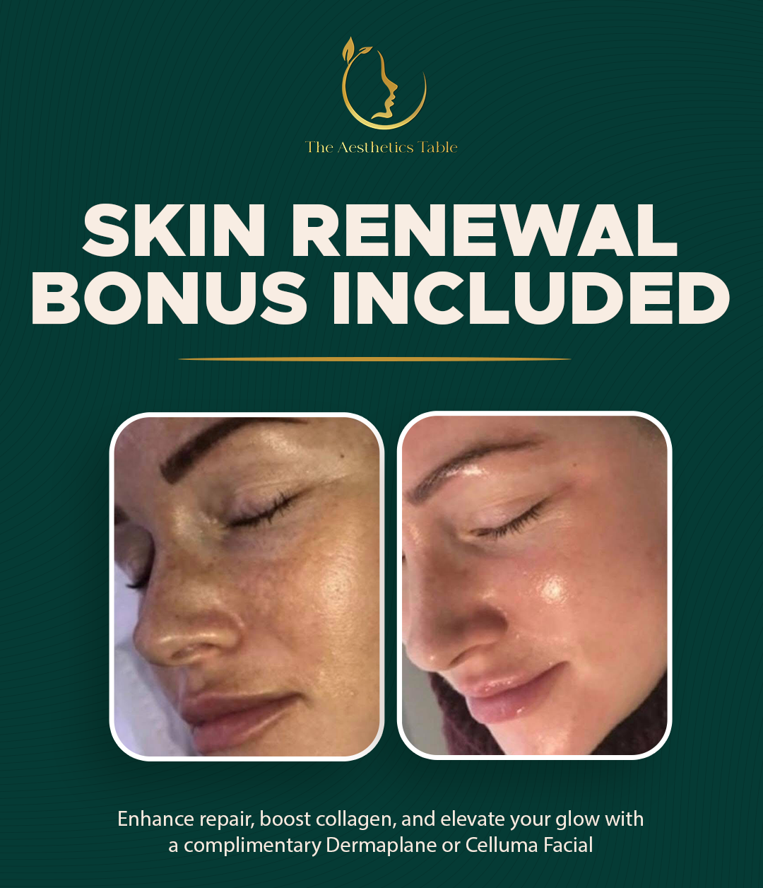 Before and after skin renewal treatment showing improved texture and radiance