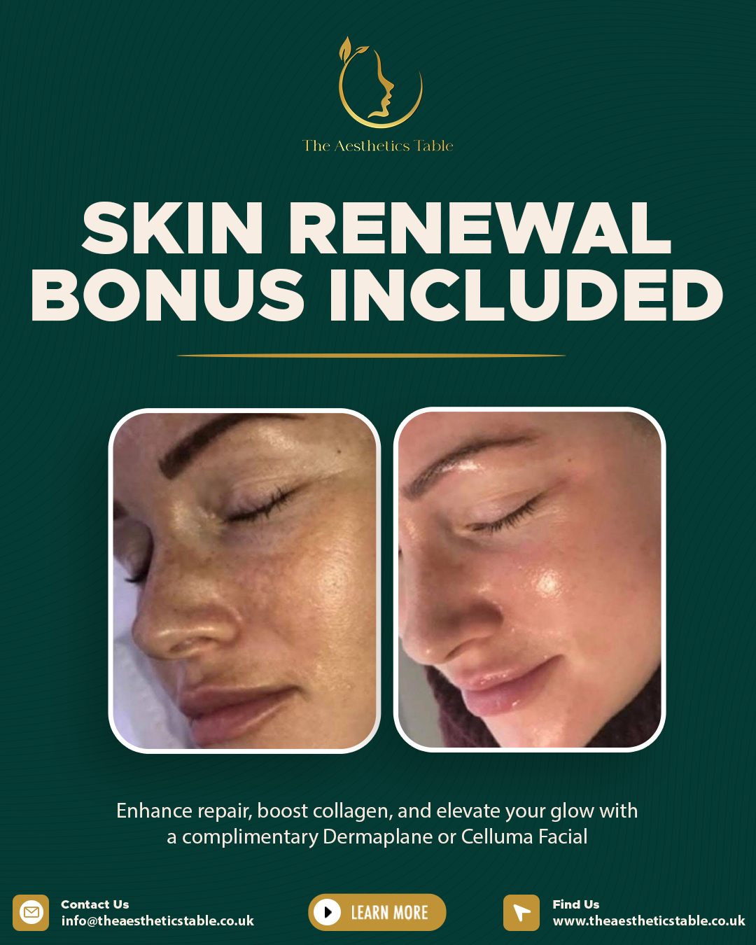 Skin Renewal Bonus - SM Post - The Aesthetics Table