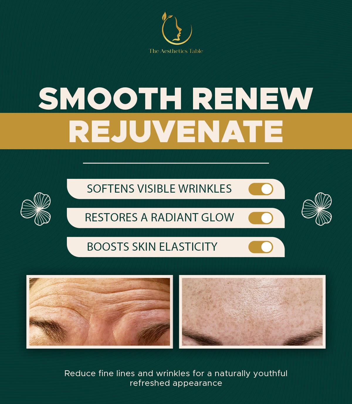 Before and after results showing smoother forehead skin and softened fine lines after aesthetic treatment