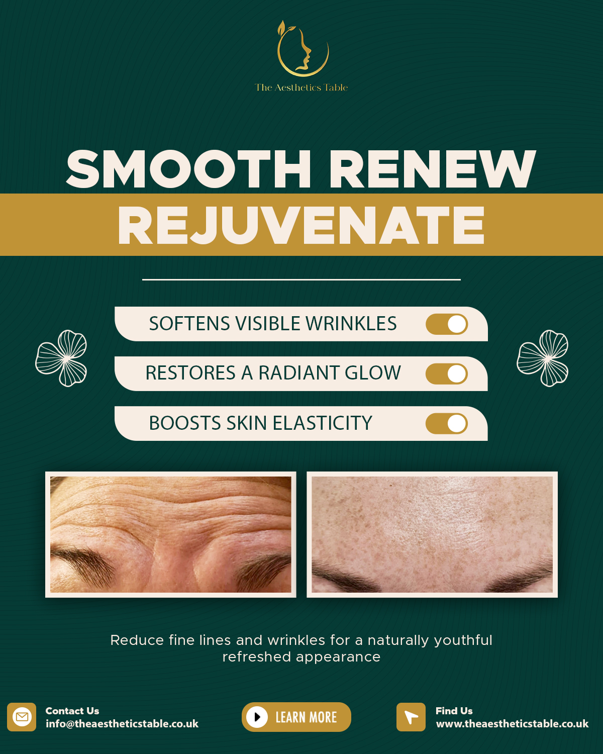 Smooth Renew - SM Post - The Aesthetics Table